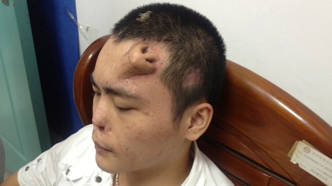 Nose on Forehead Reuters.jpg